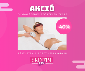 40% kedvezmény a lézeres bérletek árából!