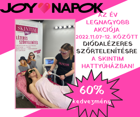 JOY napok akció diódalézeres szolgáltatásunkra!